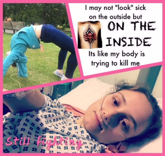collage of photos of woman doing a backbend and lying in the hospital after surgery