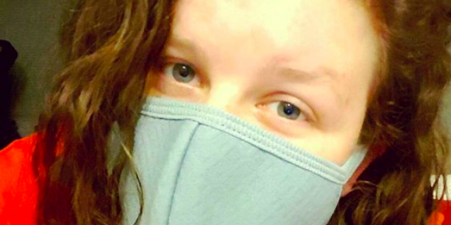 Marisha Dotson Shares Photo Journey After 'Pimple' Turns Out to Be Skin Cancer Woman with curly red hair wearing a face mask