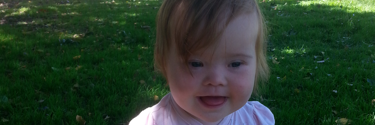 CLOSE-UP OF LITTLE GIRL WITH DOWN SYNDROME