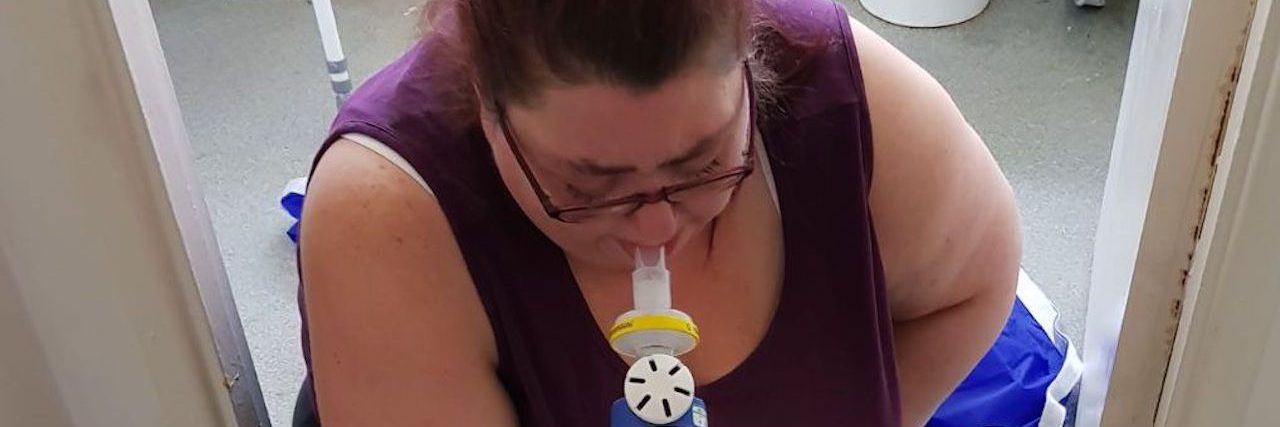 Pictures of What My Ehlers-Danlos Syndrome Looks Like