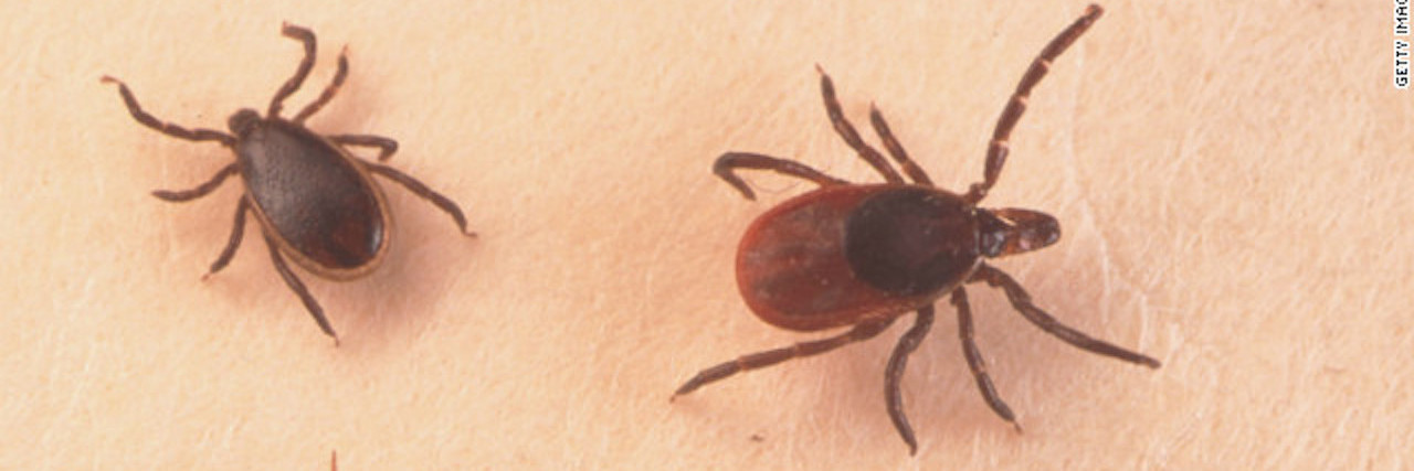 My Husband Died From Babesiosis Following a Tick Bite ticks