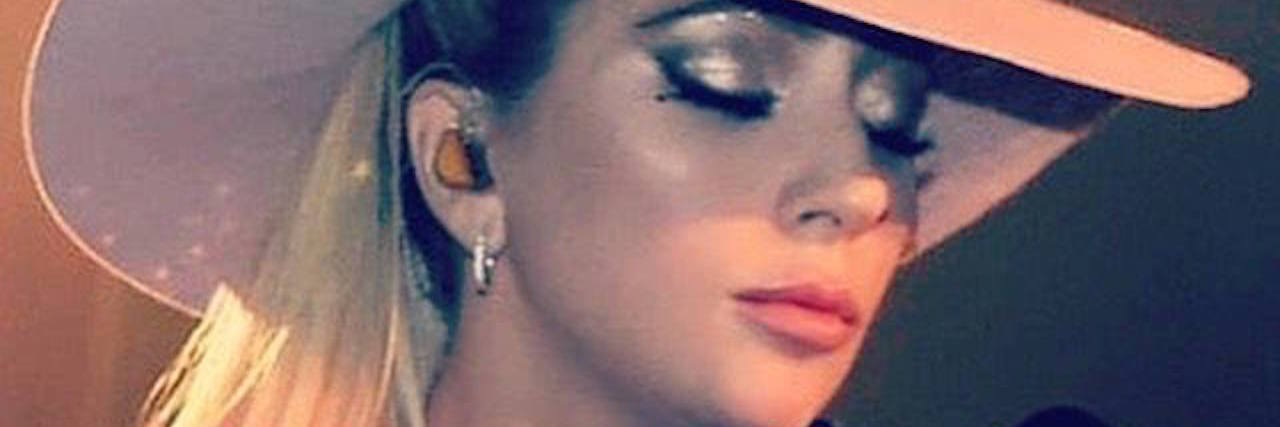 Welcome to the Spoonie Community, Lady Gaga Lady Gage holding a microphone.