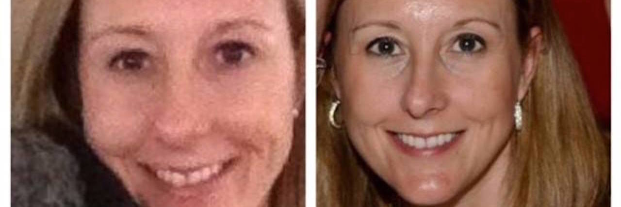 Whitney Fleming Posts Selfies to Prove Depression Doesn't Have a Look split screen of a woman smiling