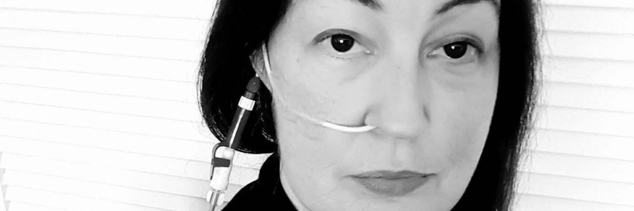 10 Things I've Learned While Mobile Tube Feeding Woman with feeding tube in her nose.