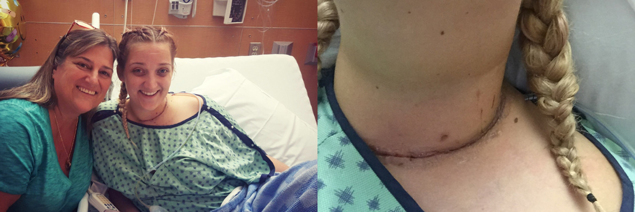 These Past Two Years Facing Thyroid Cancer Have Been Rough Carina Campanella feature