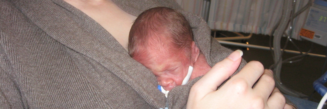 Possibilities and Promises: Surviving the NICU