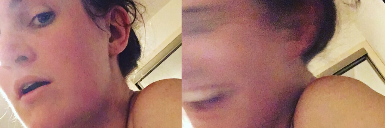 Why I Don't Want to Be Called Skinny as Someone With IBD kathleen nicholls