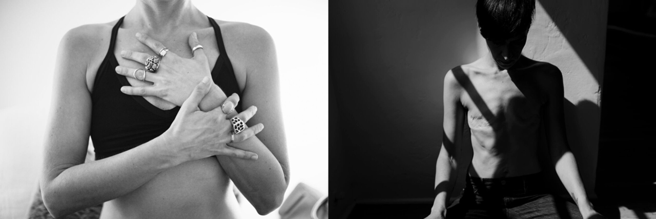 How Having Thyroid Cancer Inspired Me to Create the Last Cut Project Samantha Paige Feature