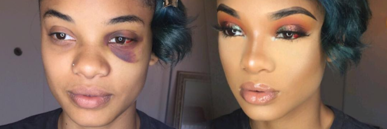 The Real Story Behind This Viral Makeup Mental Health Awareness Photo before and after makeup photo