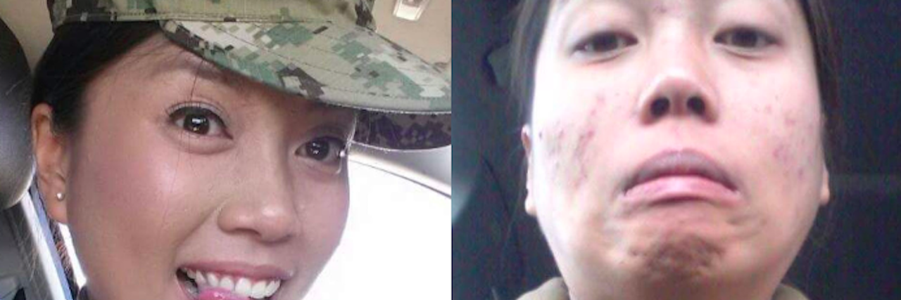 Photos People With 'High-Functioning' Anxiety Want to Post, but Don't woman