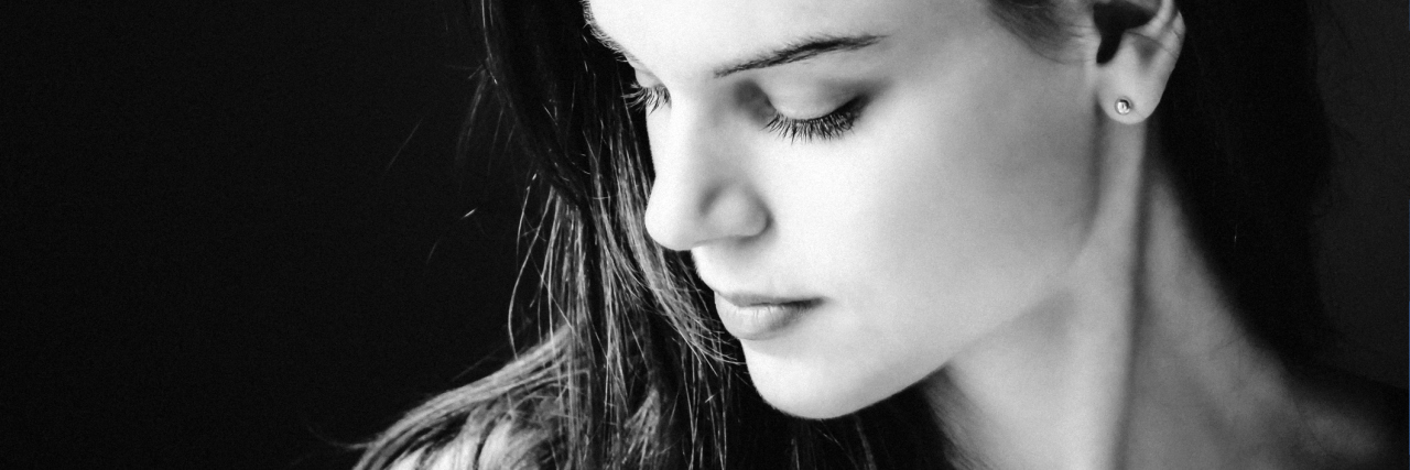 Living With Vascular Ehlers-Danlos Syndrome (vEDS) black and white photo of a woman