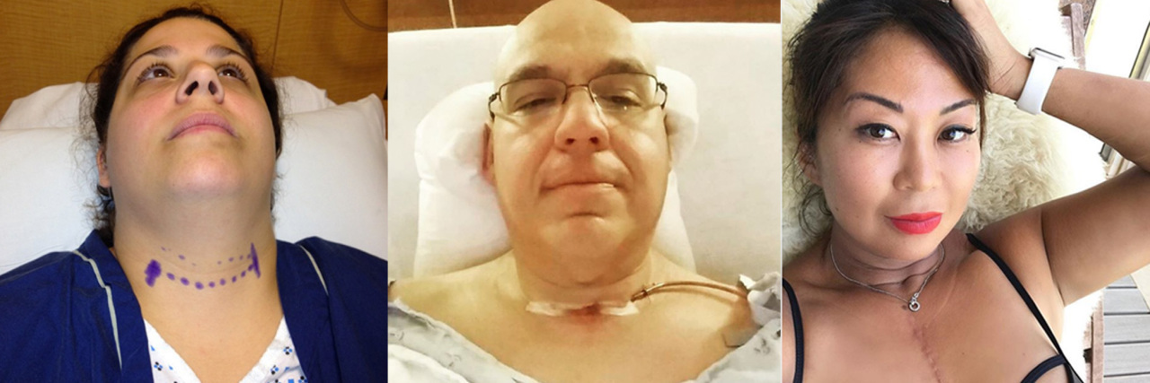 24 Selfies That Show What Thyroid Cancer Really Looks Like