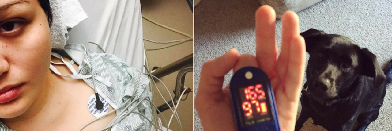 16 Photos People With Dysautonomia Want to Post, but Don't woman in the hospital next to a woman holding her heart rate monitor with her service dog sitting in front of her