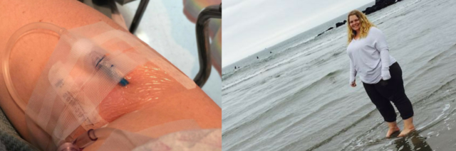 photo of an IV in a woman's arm next to photo of her standing on the beach