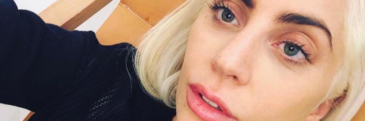 Response to Lady Gaga's Cancelled Shows Due to Fibromyalgia lady gaga