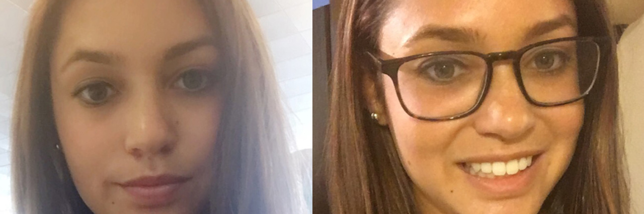 The Reality of My 'Good' Thyroid Cancer Diagnosis lilly barone feature