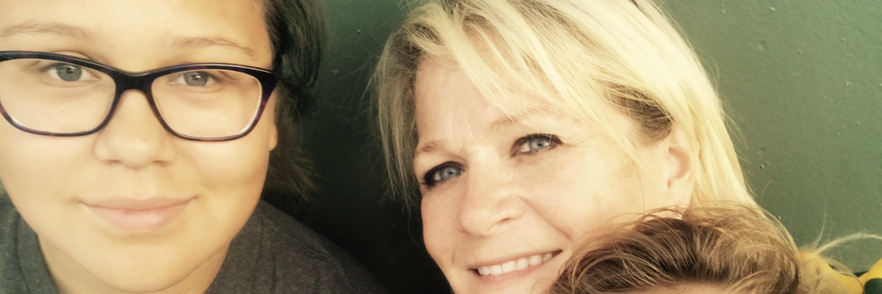 Mom Shows What Treating Pre-Cancer With Chemo Cream Looks Like Wendy Sobczyk "before," with kids