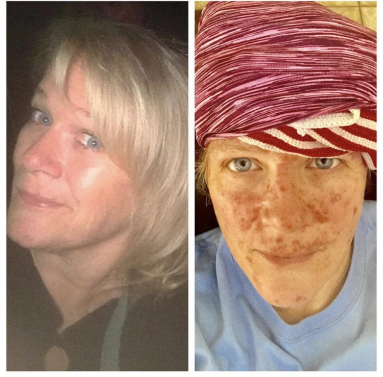 Wendy Sobczyk (Before and Day 17, Round 1)