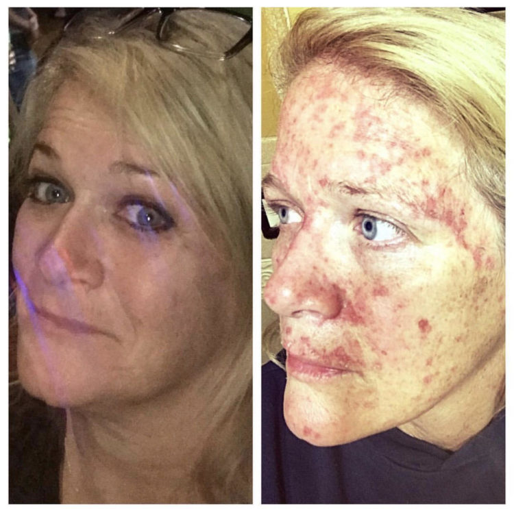 Wendy Sobczyk (Before and Day 18, Round 1)