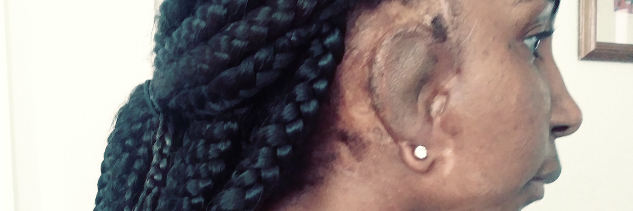 I Am Beautiful, Even With Craniofacial Difference and Imperfections woman with her hair pulled back