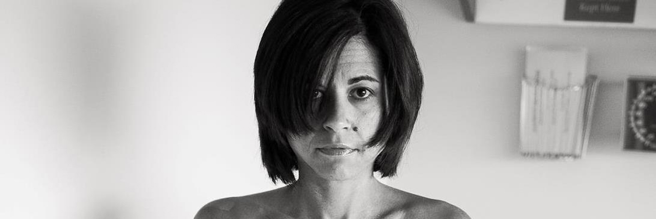 I Didn't Ask for a Tummy Tuck or Boob Job. I Had Breast Cancer. Annmarie Otis breast surgery