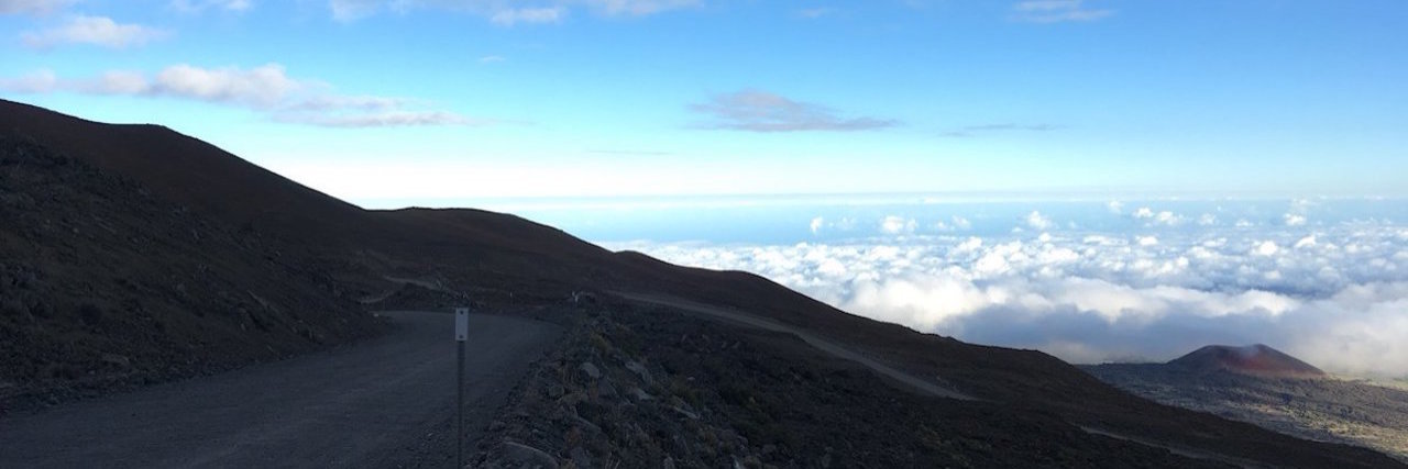 Importance of Family and Friends in Healing Emotionally From Lupus Mount Mauna Kea in Hawaii
