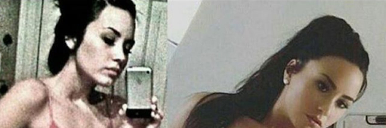 Demi Lovato Shared Problematic Before and After Recovery Pictures before and after photo of demi lovato