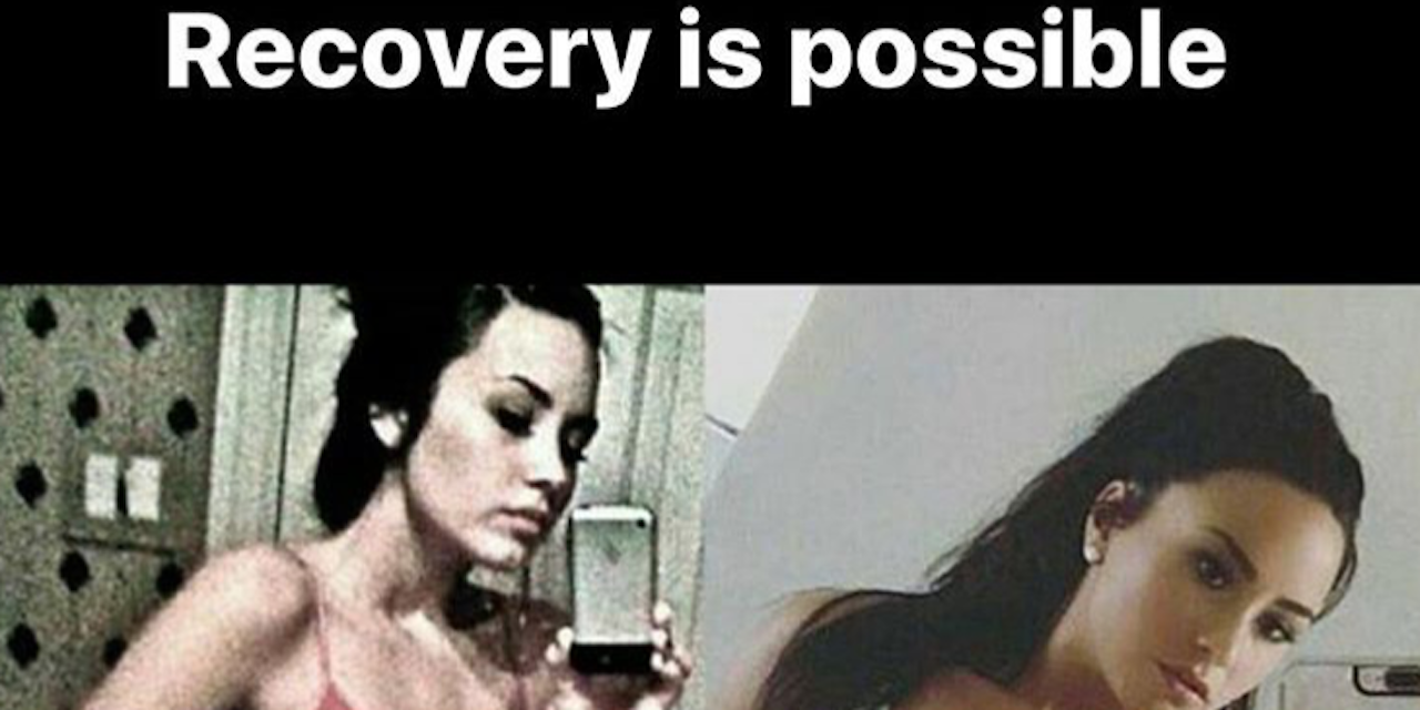 Demi Lovato Shared Problematic Before and After Recovery ... - 1280 x 640 jpeg 81kB