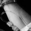 black and white photo of a woman's arm with a bracelet that says 'live' and an IV in her arm