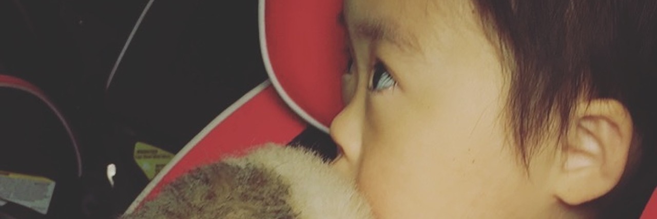 I Adopted My Daughter Who Has Down Syndrome