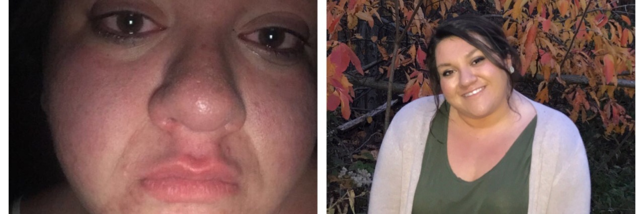 What Anxiety Really Looks Like