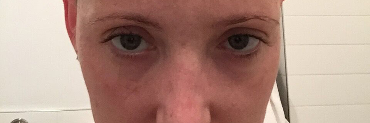 Drugs, Hugs, and Losing My Jugs: A Breast Cancer Journal-June 12, 2015