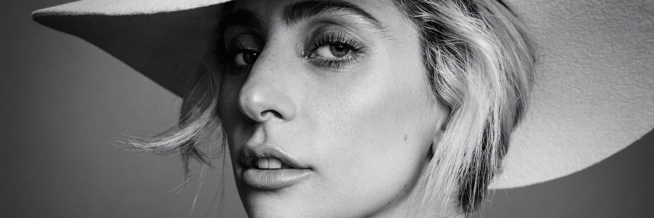 Juvenile Dermatomyositis: Lady Gaga Helps Me to Speak Up About Illness black and white photo of lady gaga