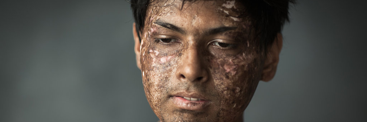 How I Out-Thought Cancer and Finally Became Happy With Myself