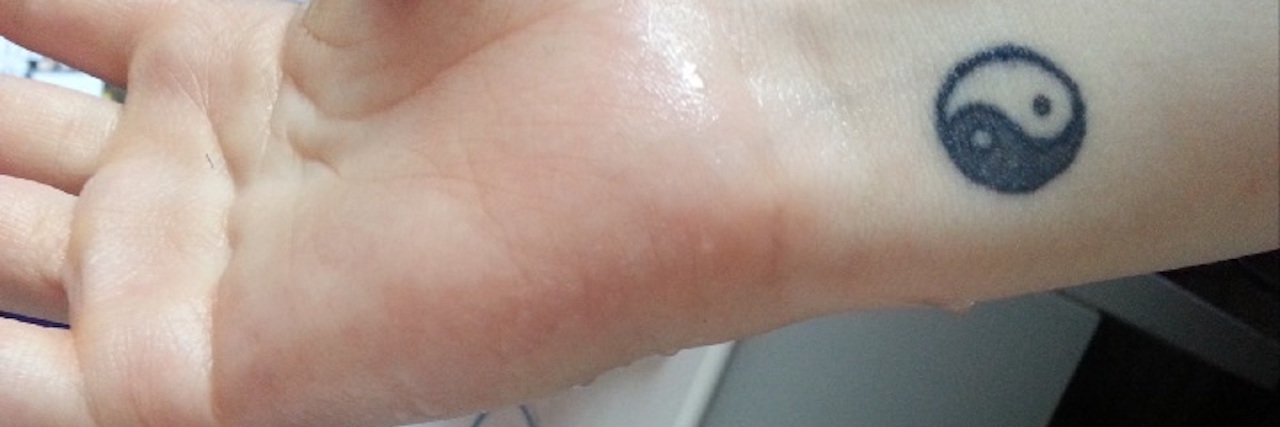 What It's Like to Sweat Excessively Due to Hyperhidrosis woman's hands sweating