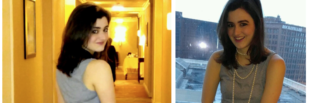 Appearing Healthy With Reflex Sympathetic Dystrophy Syndrome