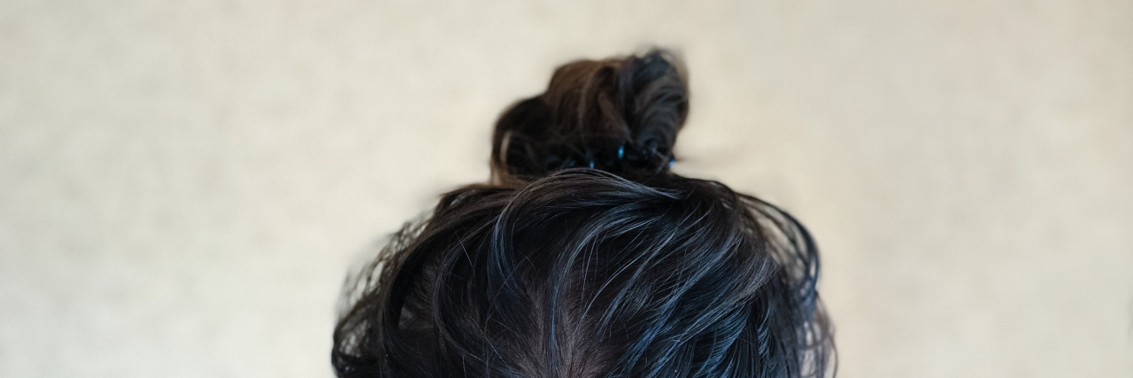 Why My Depression Isn’t Romantic Head of female with dirty greasy hair