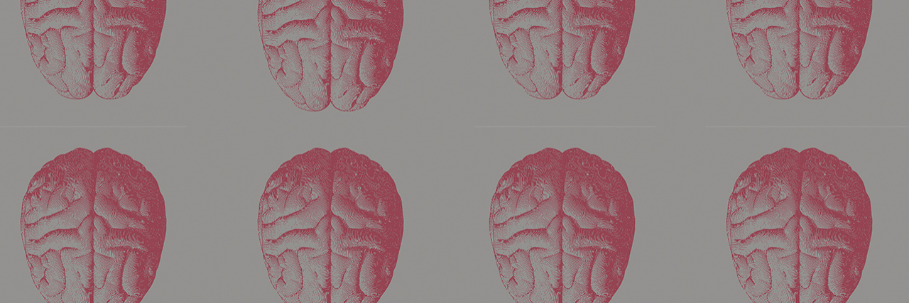 Please Stop Calling Depression a 'Chemical Imbalance' brains
