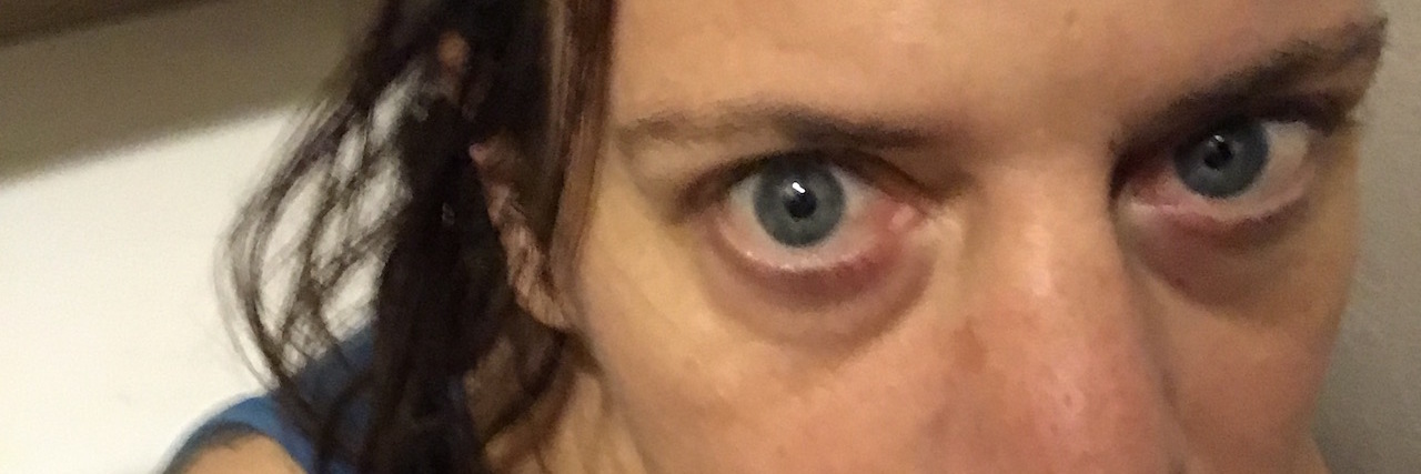 The Reality of Living With Chronic Illness woman sitting on the toilet feeling sick