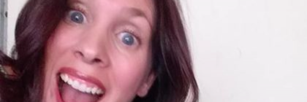 Mom Shares Photo of 'Underground Pimple' That Turned Out to Be Skin Cancer Woman with brown hair, blue eyes, and big smile