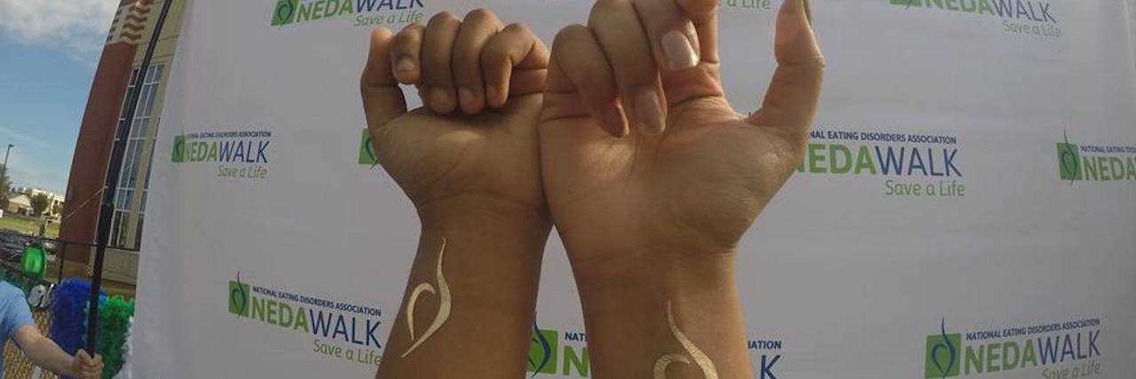 hands with NEDA recovery symbol on their wrists