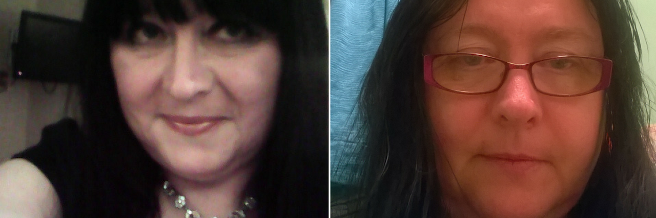 How Fibromyalgia Can Affect Your Physical Appearance Over Time