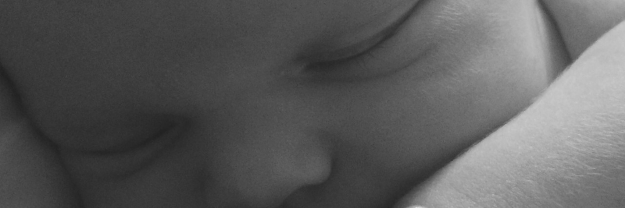 It Is Not 'Just a Hand' Baby with limb difference sleeping