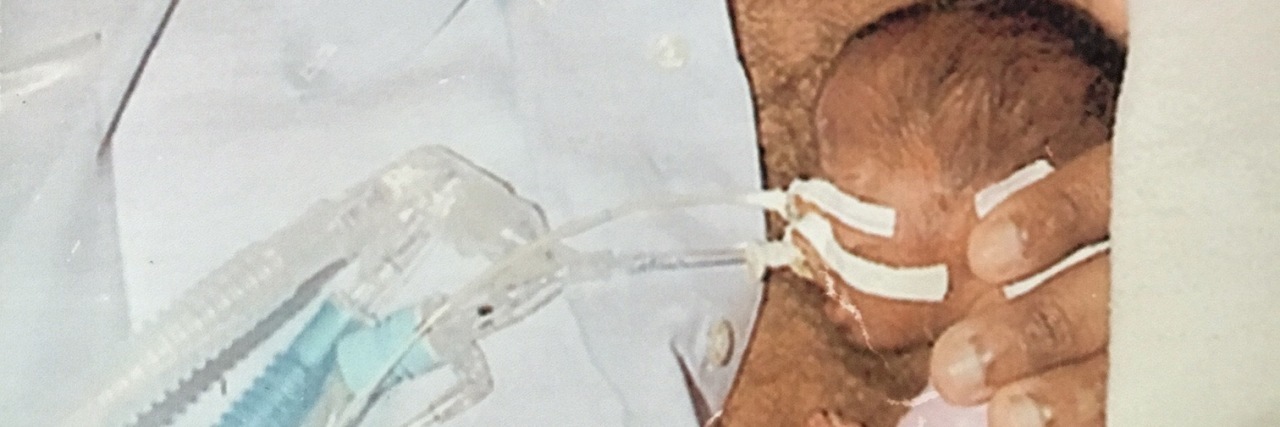 It's Not Your Fault Your Child Was Born Premature