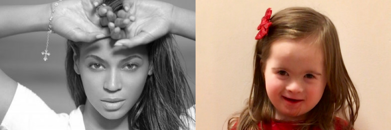 Beyonce and little girl with Down syndrome side by side pictures