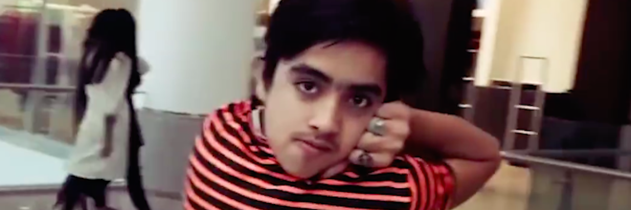 What Lad Bible's 'Human Owl' Video Got Wrong About Hypermobility boy twisting head behind his back