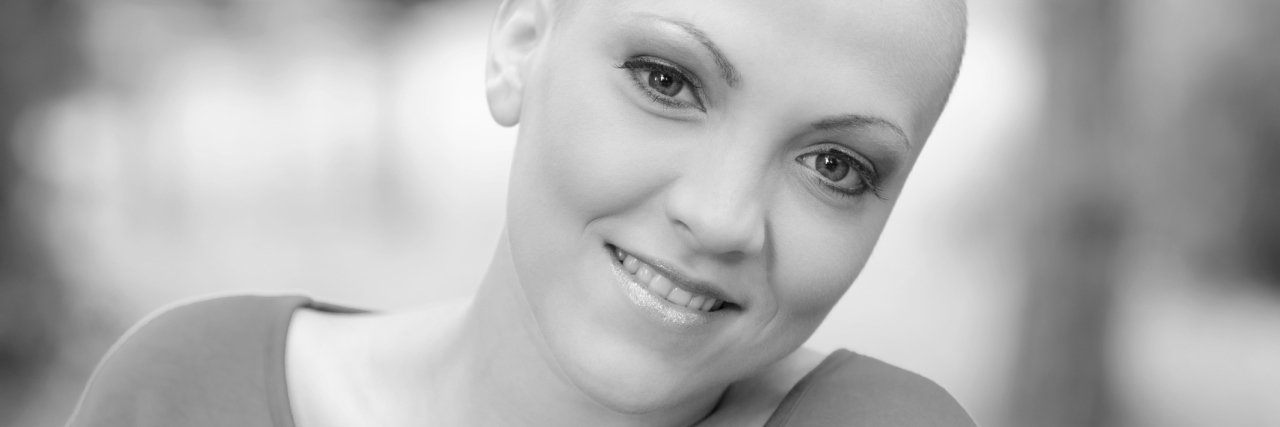 What It's Like Losing Your Hair as a Teenager Due to Alopecia Areata A young teenager who doesn't have any hair.