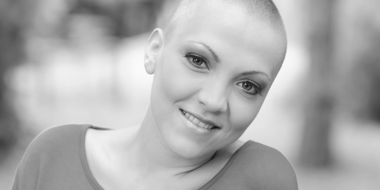 What It S Like Losing Your Hair As A Teenager Due To Alopecia