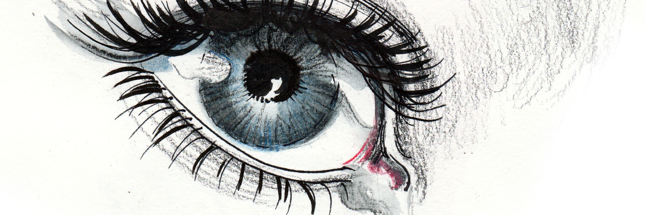 Feeling Sad and Grieving Your Chronic Pain
