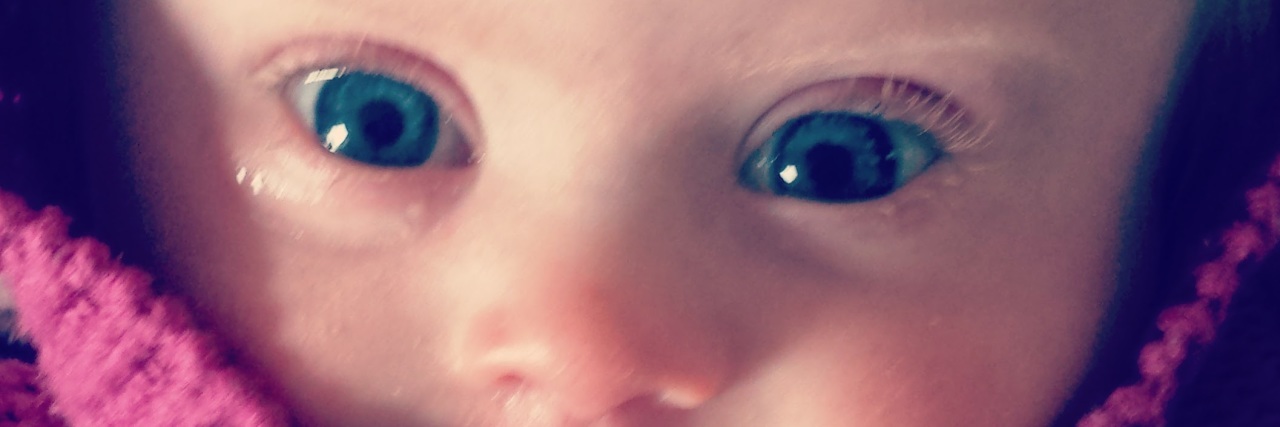 A Positive Spin on the Negative Terms Regarding Down Syndrome